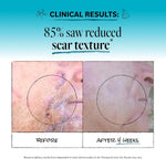 DERMA E Scar Gel, Hydrating, Fast-Acting Scar Treatment, 2 Oz - Image 4