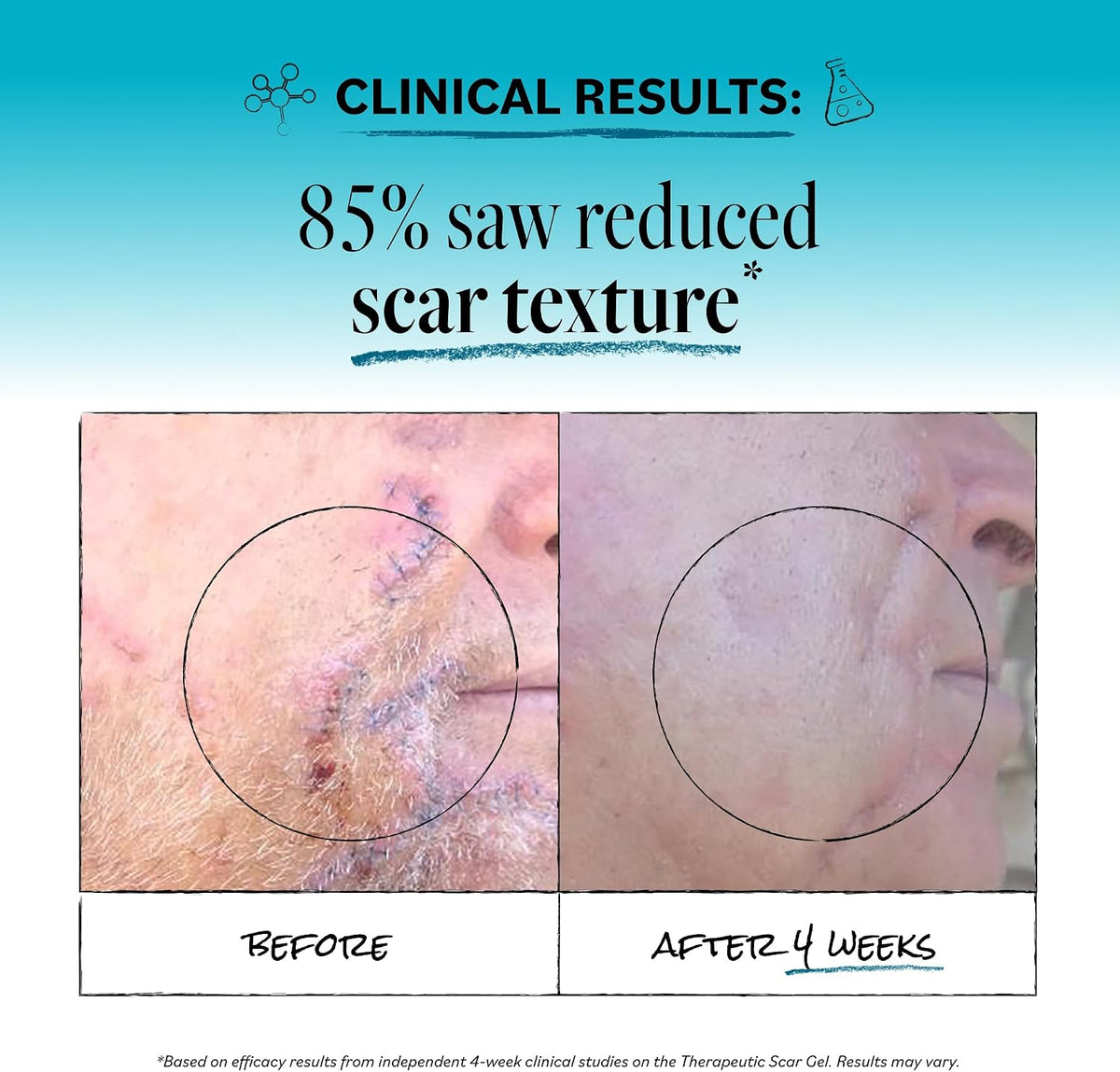 DERMA E Scar Gel, Hydrating, Fast-Acting Scar Treatment, 2 Oz - Image 4