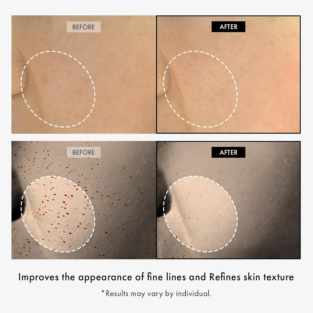 Complete presentation of the imported TOSOWOONG youth volume skincare kit.