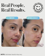 Kate Somerville 3 percent sulfur clinical strength cleanser cream texture on a white background