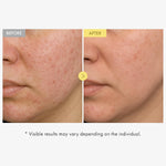 Brightening niacinamide and kojic acid serum by Tosowoong for evening out skin tone.