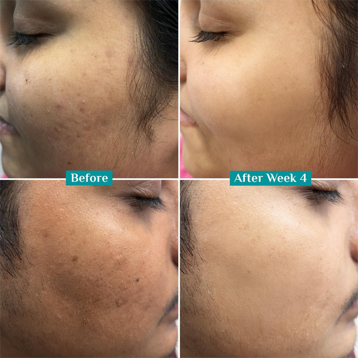 Side profile of Pilgrim face serum bottle with brand logo clearly visible.