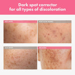 TOSOWOONG Arbutin 7 Percent Intensive Spot Cream squeeze tube for hyperpigmentation