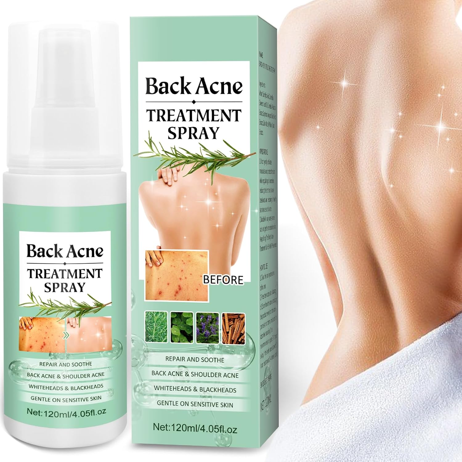 Rossy Back Acne Treatment Spray 120ml front bottle view for clearing body breakouts.