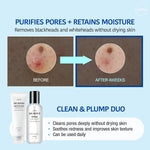 JUMISO blackhead remover kit for strawberry nose showing specialized cotton pads