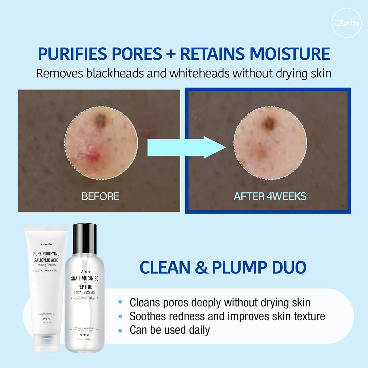 JUMISO blackhead remover kit for strawberry nose showing specialized cotton pads