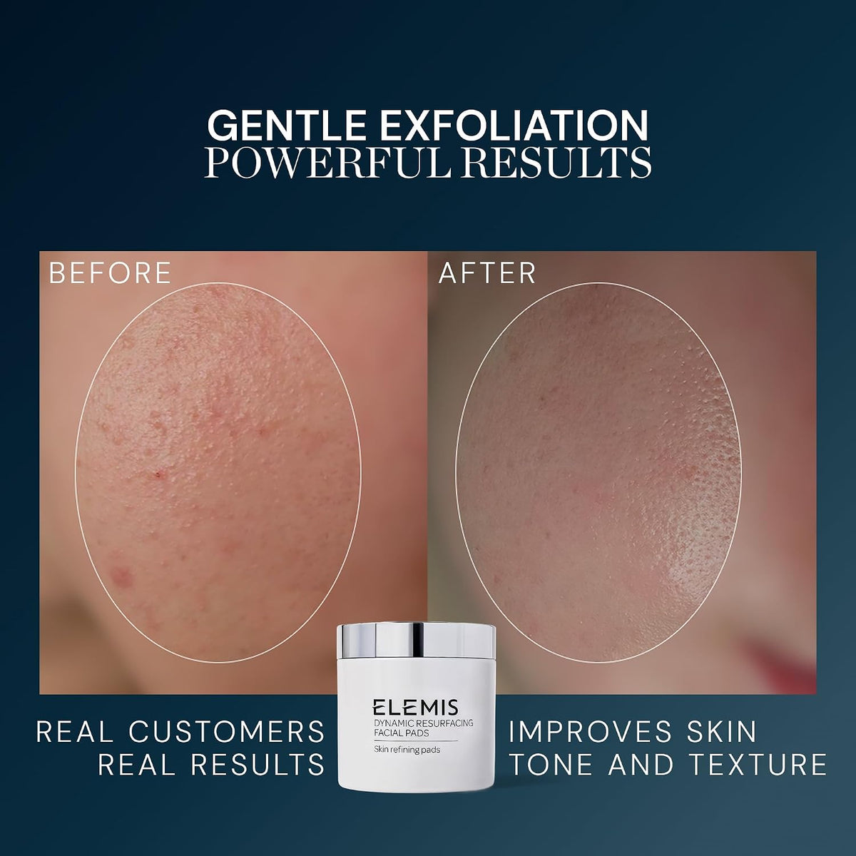 Close up view of the textured dual action side of an ELEMIS Dynamic Resurfacing pad.