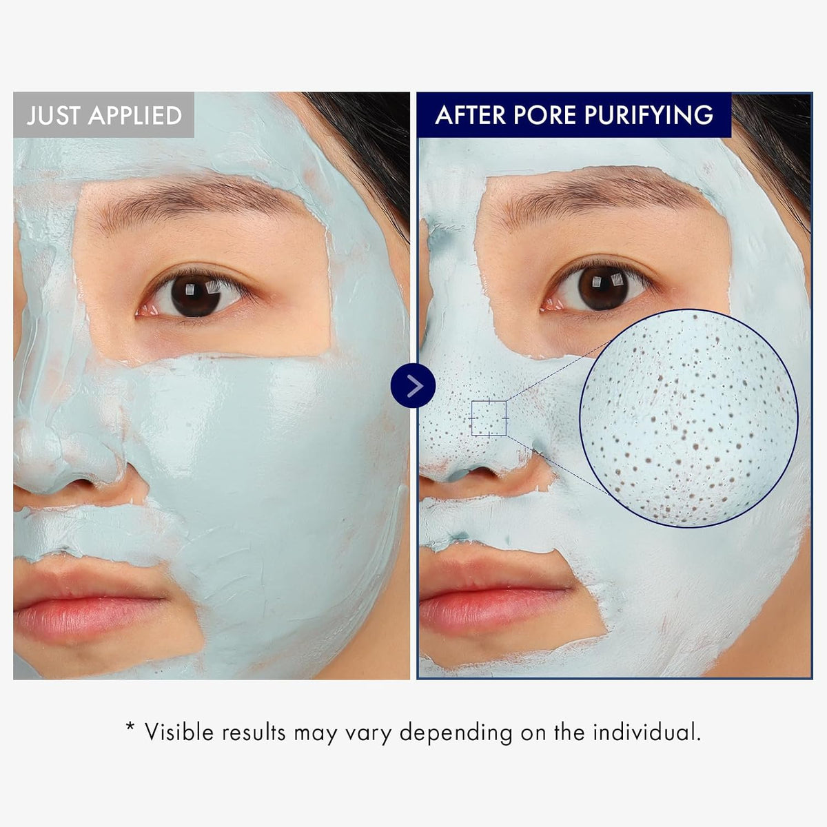 Tosowoong Real Blackhead Mud Mask application on nose area