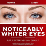 Clear Eyes Maximum Redness Relief Eye Drops dropper tip view