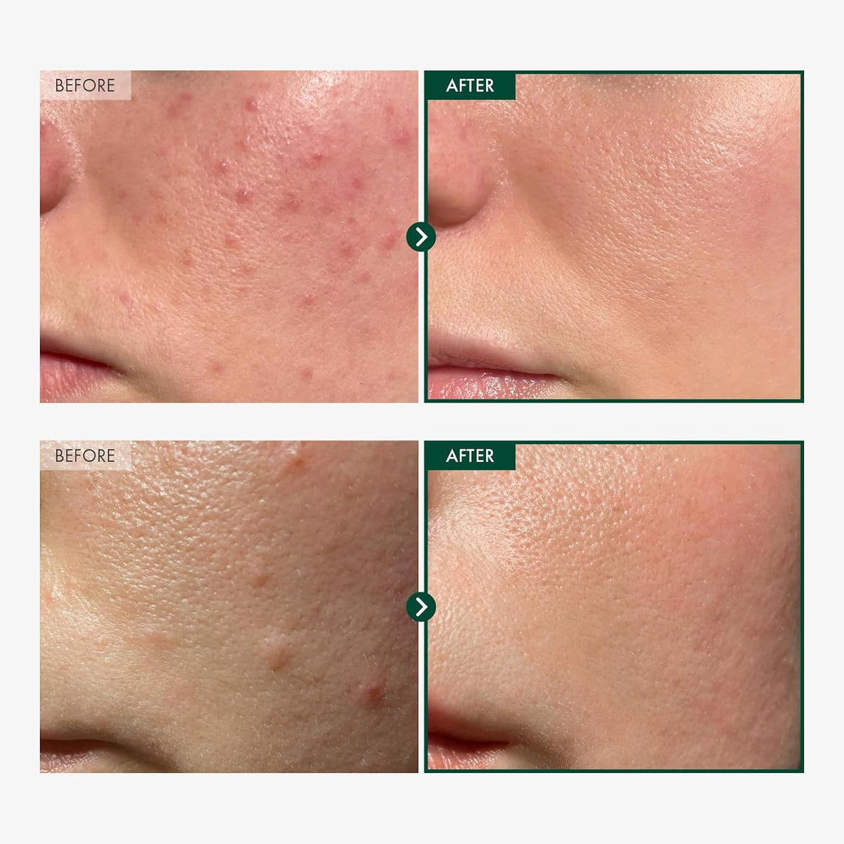 Tosowoong Korean skincare calming facial serum packaging and product bottle on a clean background.