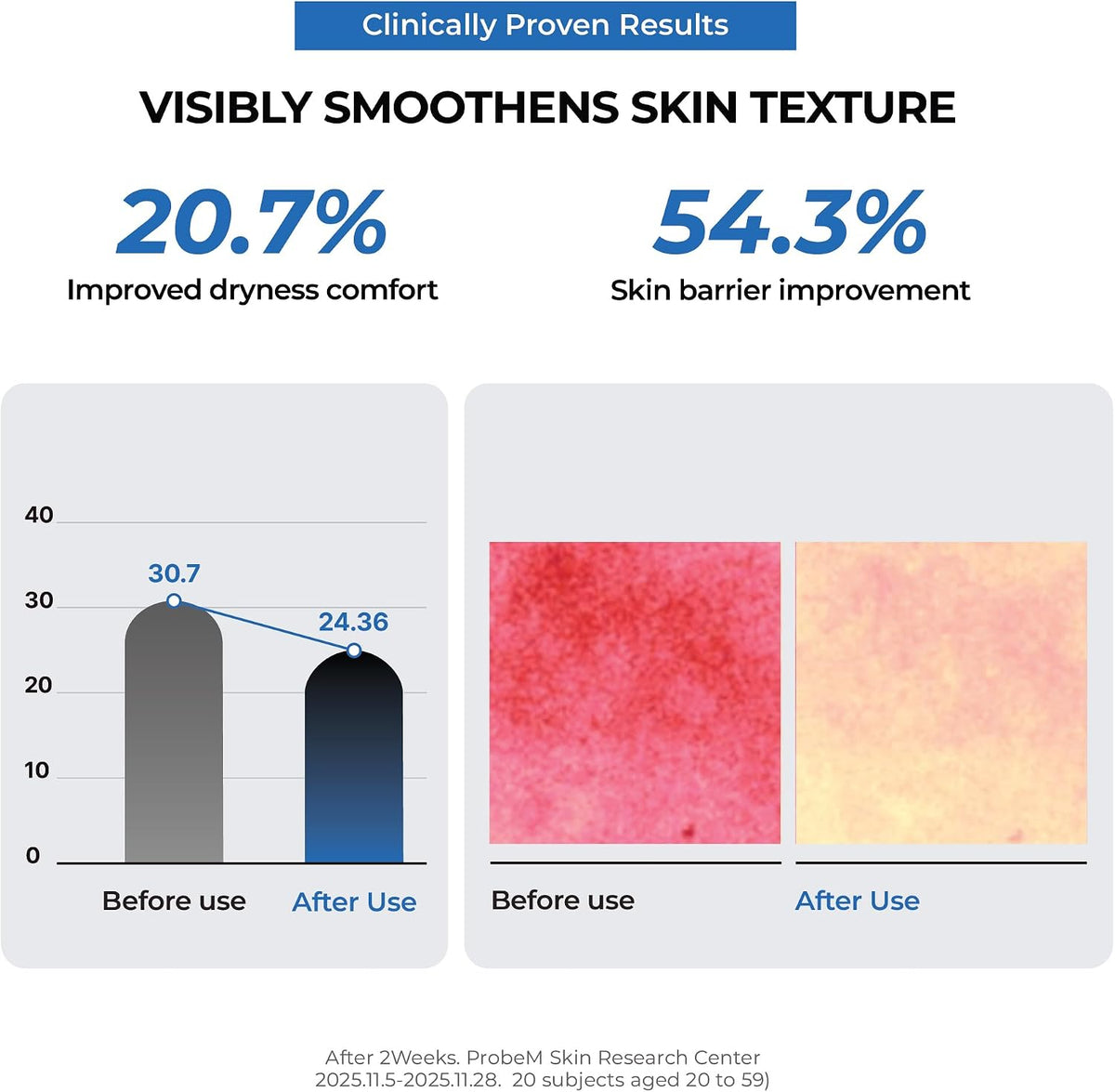 Jumiso Urea 5 Intensive Moisture Cream application on dry skin