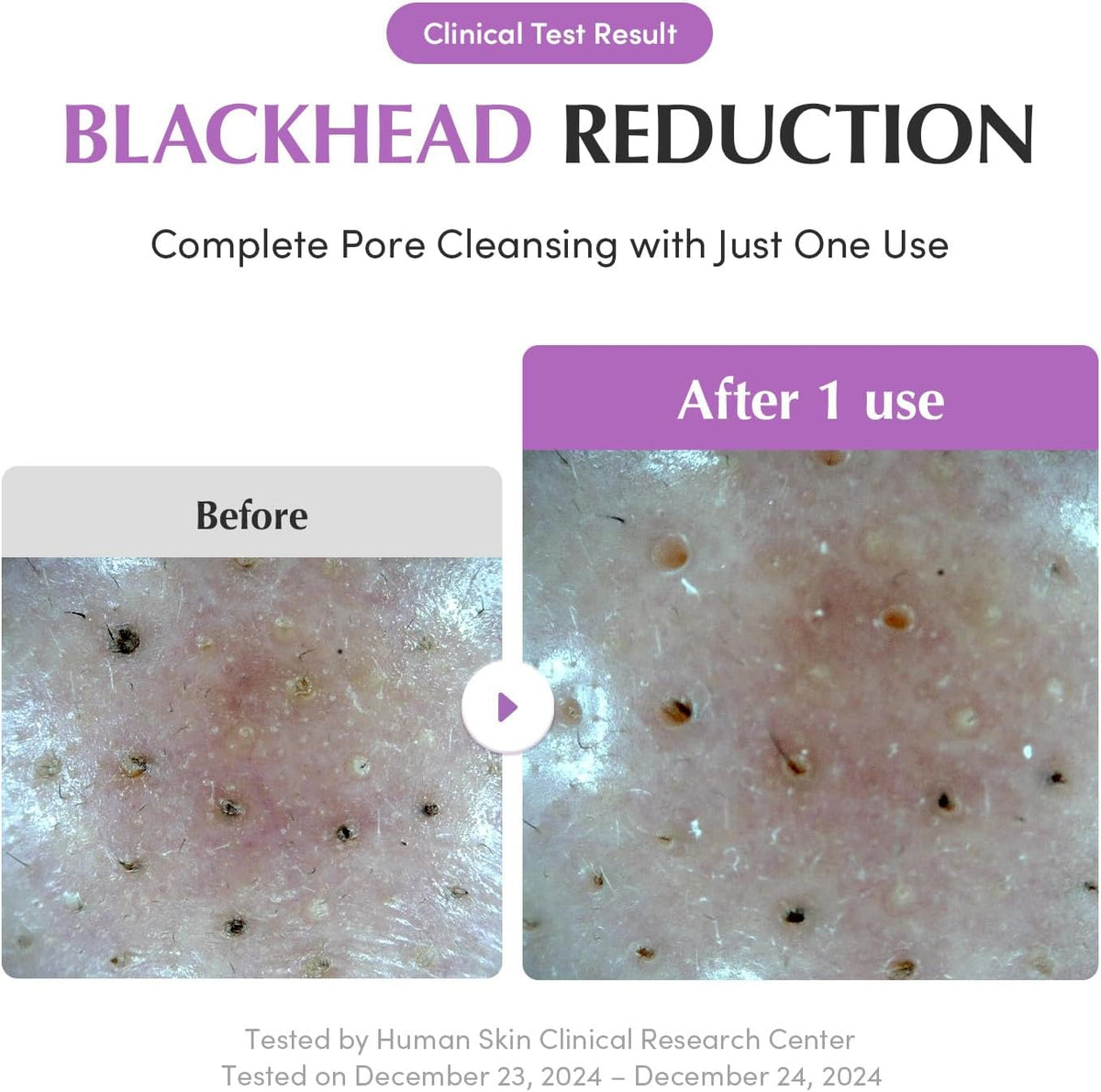 Eqqualberry Purple Rice Pore Purifying Pack Cleanser foam lather demonstration