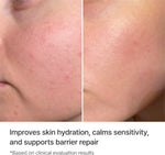 Rejuran Moisture Treatment Essence branding on bottle