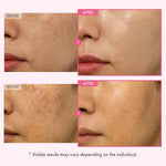 Lightweight texture of Tosowoong blemish and freckle removal facial moisturizer