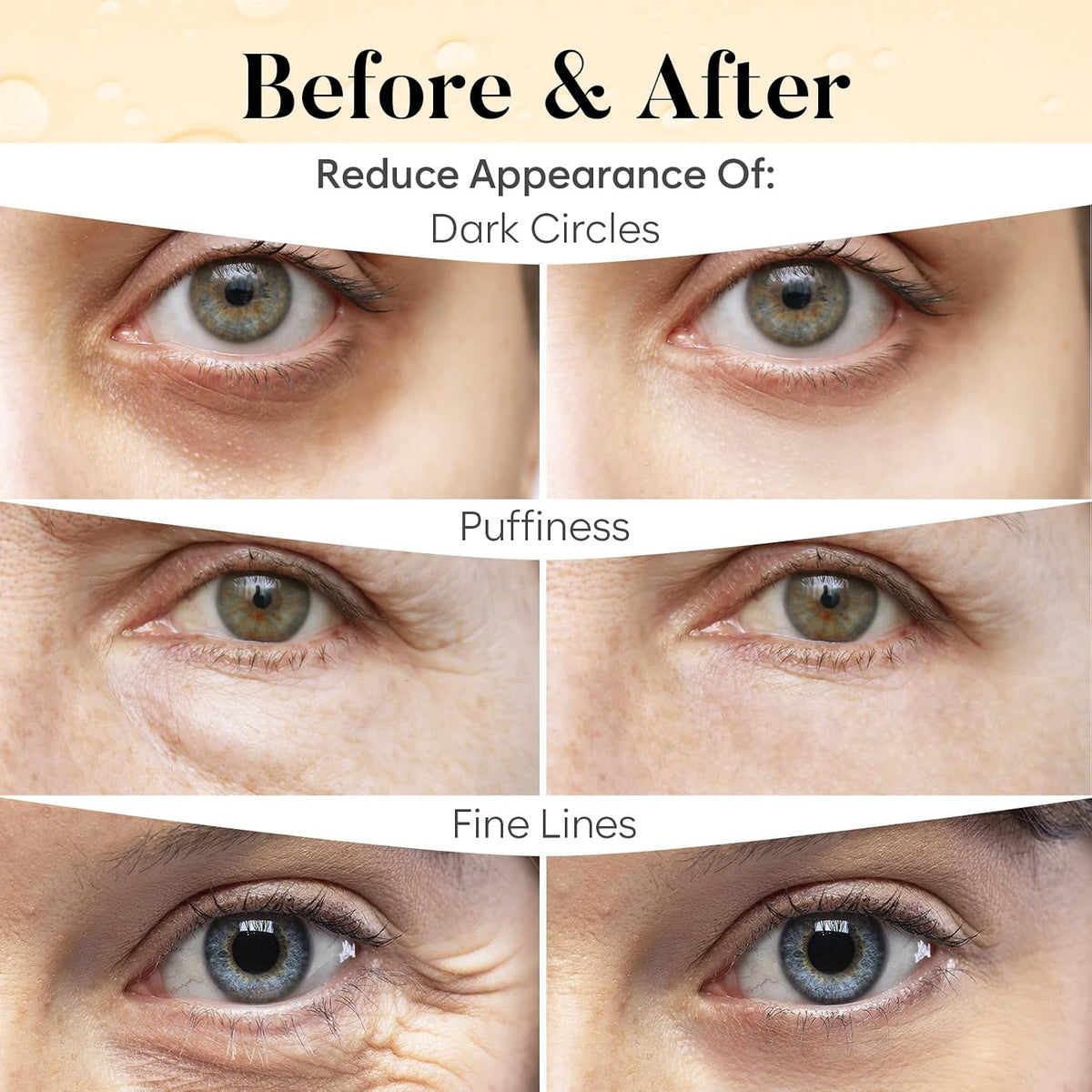 Model wearing Bloomora Vitamin C eye patches under eyes