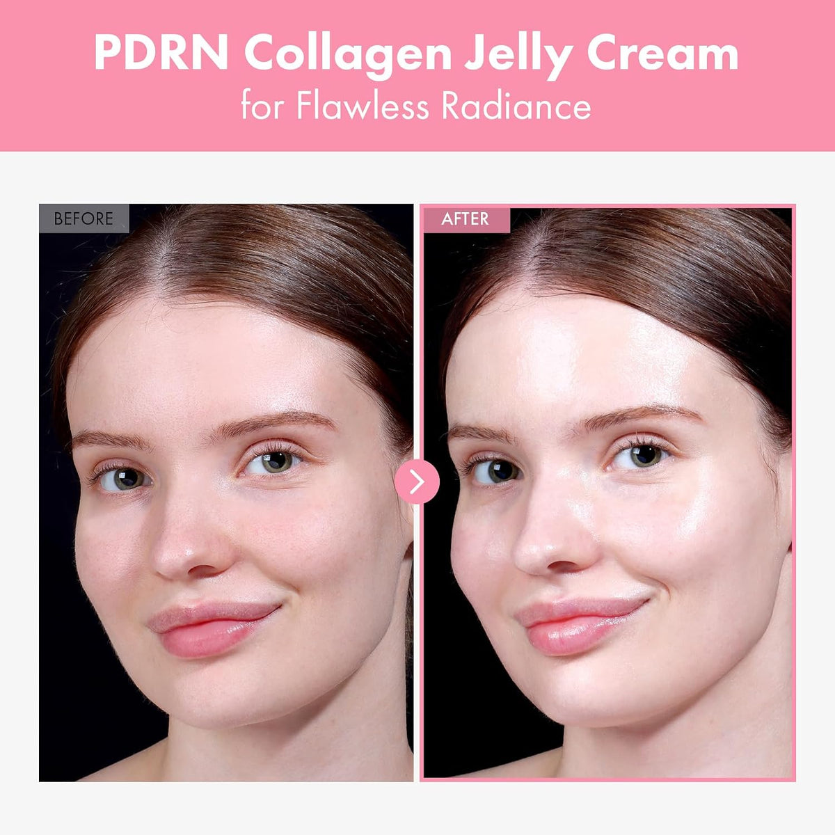 Tosowoong 5000ppm salmon DNA PDRN moisturizer packaging details