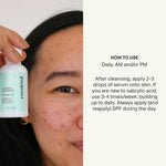 Cocokind gentle acne clearing serum with beta glucan ingredient details