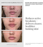 Murad pore decongesting clear and prevent blemish treatment application