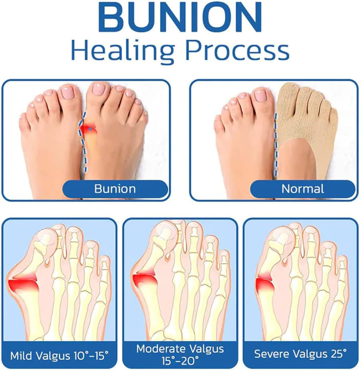 Qauxbul women toe socks showing silicone non slip bottom