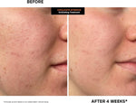 Back label instructions on the Kate Somerville intensive exfoliating scrub