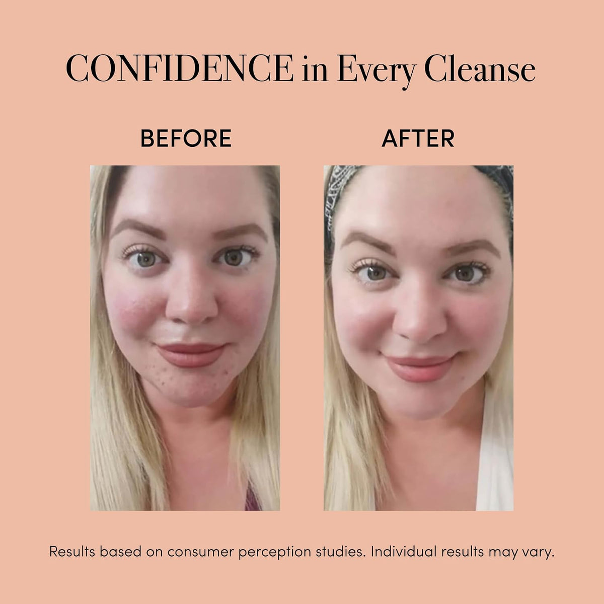 Revive Lux Collection LED acne wand showing treatment head detail