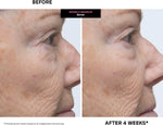 Kate Somerville Wrinkle Warrior(R) 2-in-1 Plumping Moisturizer + Serum - Hydrating Formula with Hyaluronic Acid, Smooths Fine Lines, Firms Skin & Boosts Radiance, 1.7 Fl Oz - Image 9