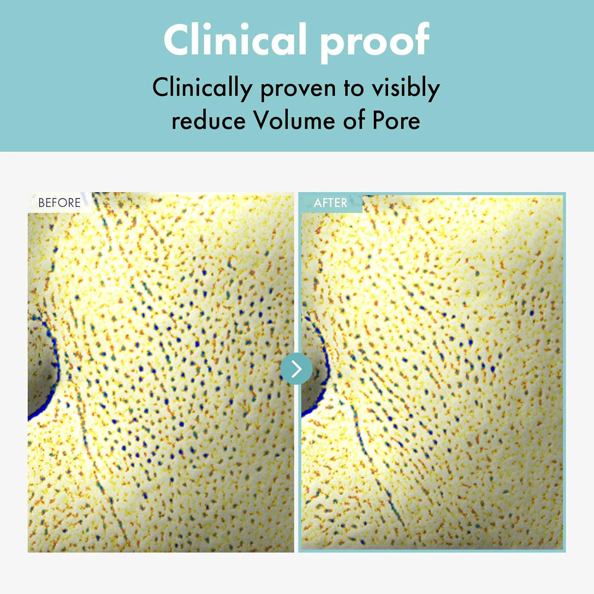 TOSOWOONG SOS Tightening Pore Clinic cream tube packaging