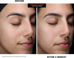 Kate Somerville ExfoliKate Cleanser - Daily Exfoliating Foaming Face Wash - Clinically Formulated Glycolic Acid and Lactic Acid Gentle Facial Scrub - Image 9