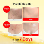 Eqqualberry brightening cream applied on hand skin