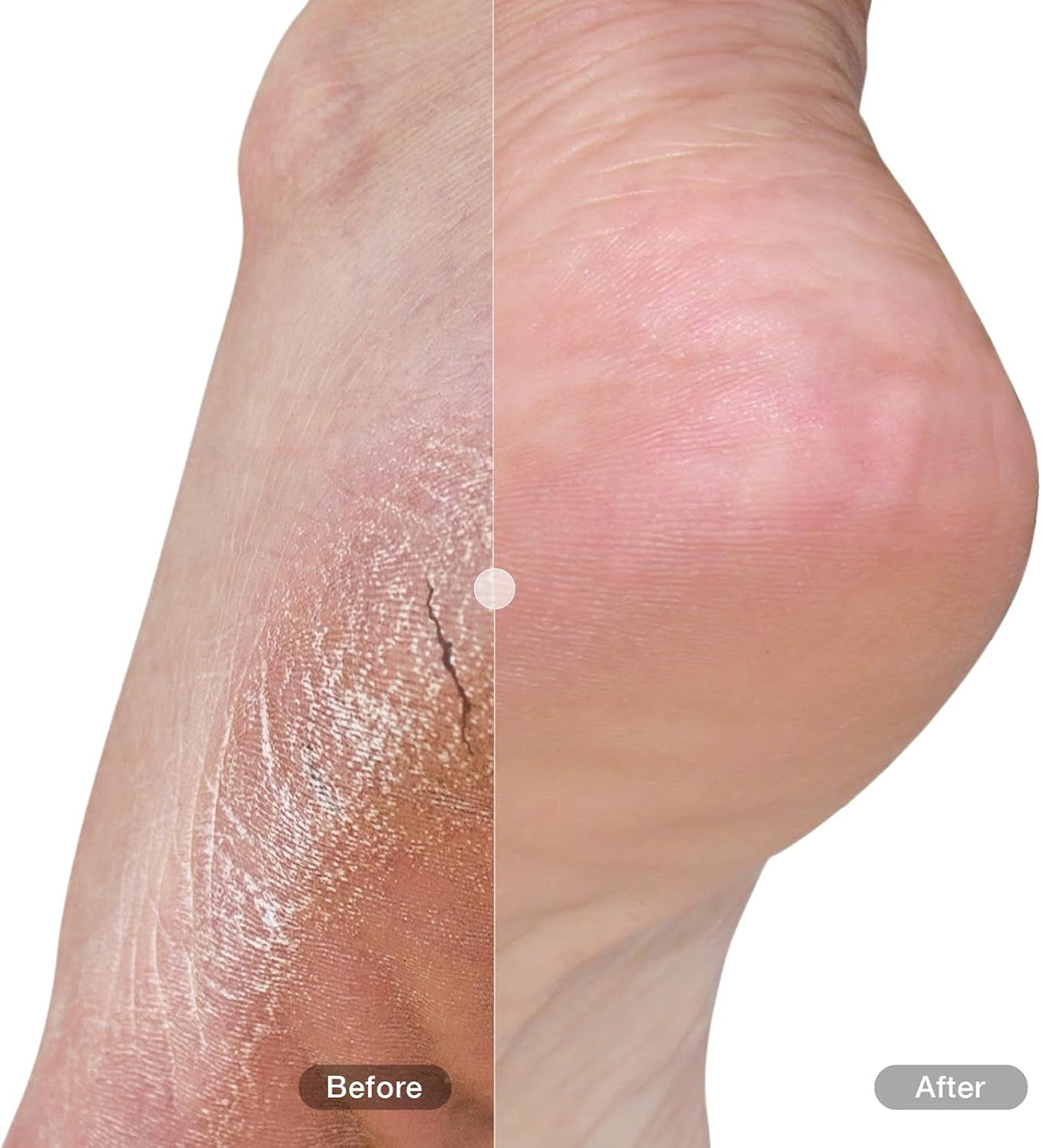 DU'IT Foot and Heel Balm Plus 50ml box container