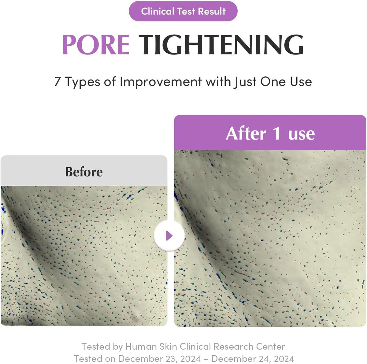 Eqqualberry Purple Rice Pore Purifying Pack Cleanser application on skin