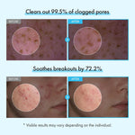 Korean skincare foaming cleanser for acne prone skin being lathered in hands