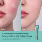 Rejuran Recover Firming Cream packaging with c-PDRN label