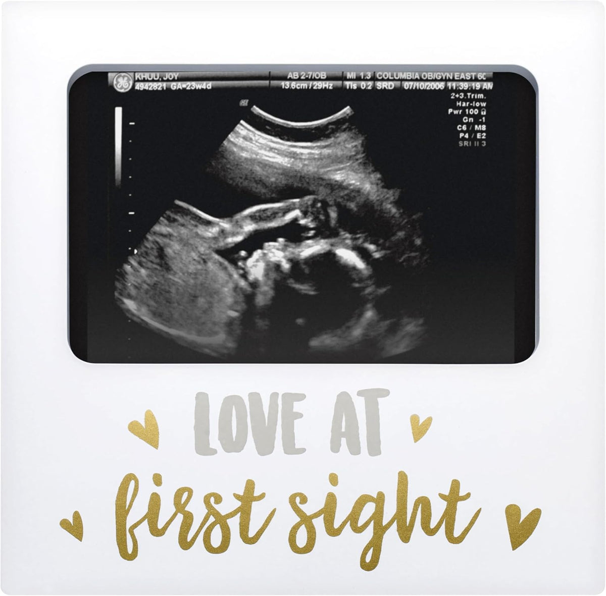 Tiny Ideas Love at First Sight Sonogram Picture Frame front view displaying a baby ultrasound photo.