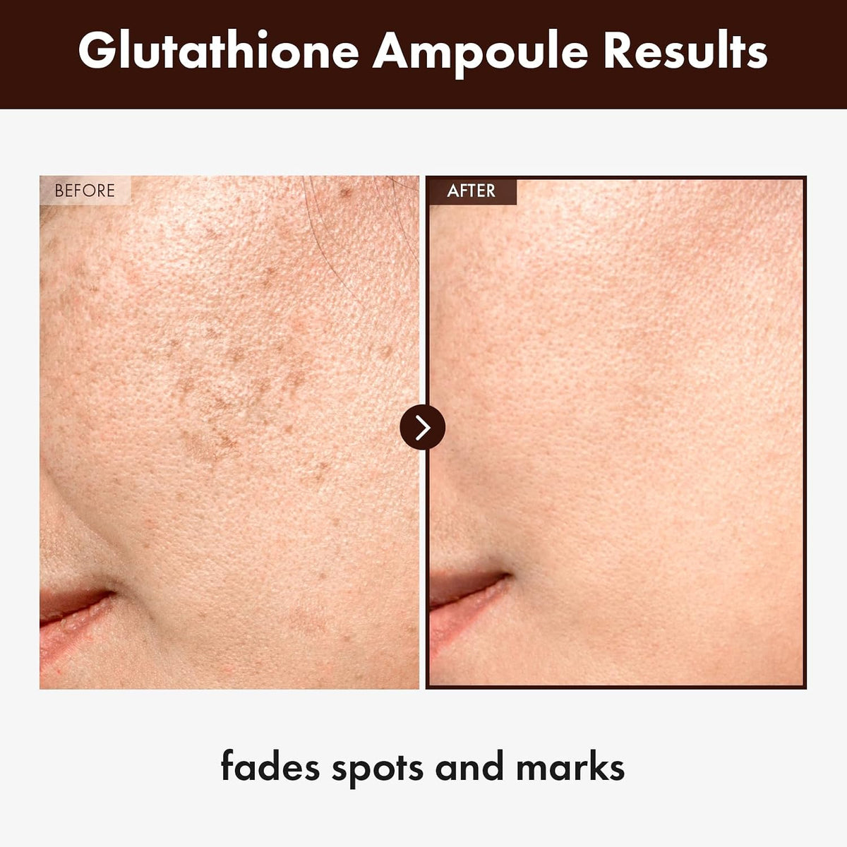 Tosowoong K-beauty glutathione ampoule 30ml packaging for evening skin tone