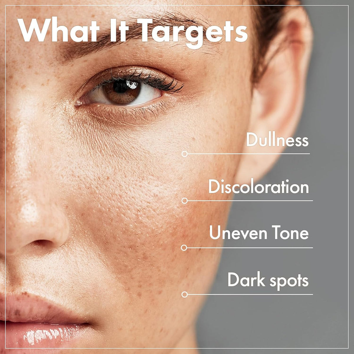 Authentic Tosowoong hyperpigmentation care cream imported for Indian skincare routines