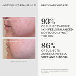 Side view of Murad Daily Clarifying Peel 95ml bottle for skincare routine.