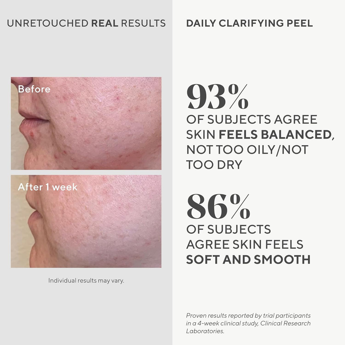 Side view of Murad Daily Clarifying Peel 95ml bottle for skincare routine.