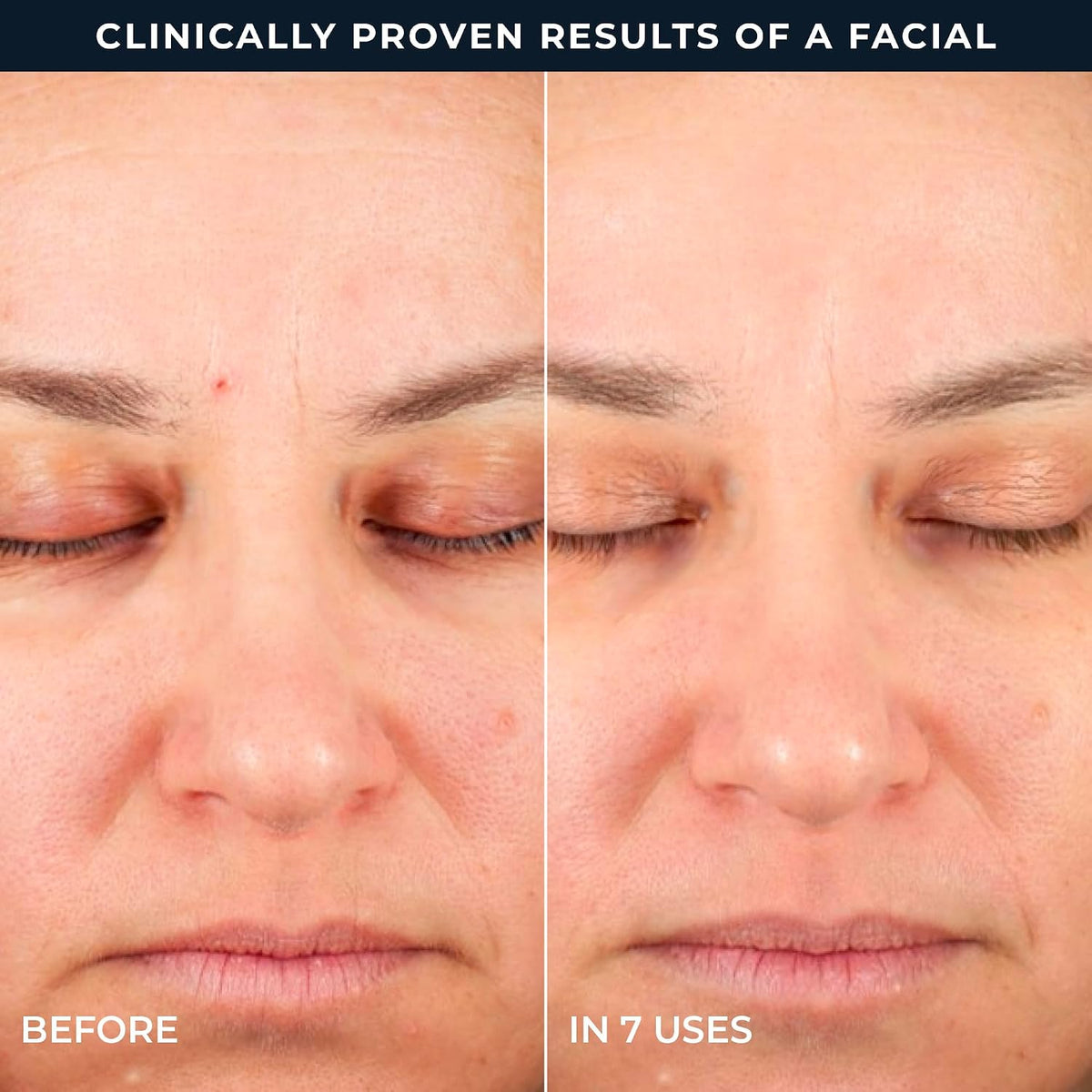 USA imported RoC Retinol line smoothing treatment box showing complete drug facts and ingredients