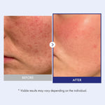 Texture shot of Tosowoong Korean skincare barrier cream showing its lightweight white cream formula