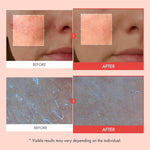 TOSOWOONG premium K-beauty resurfacing bundle for minimizing bumpy skin texture