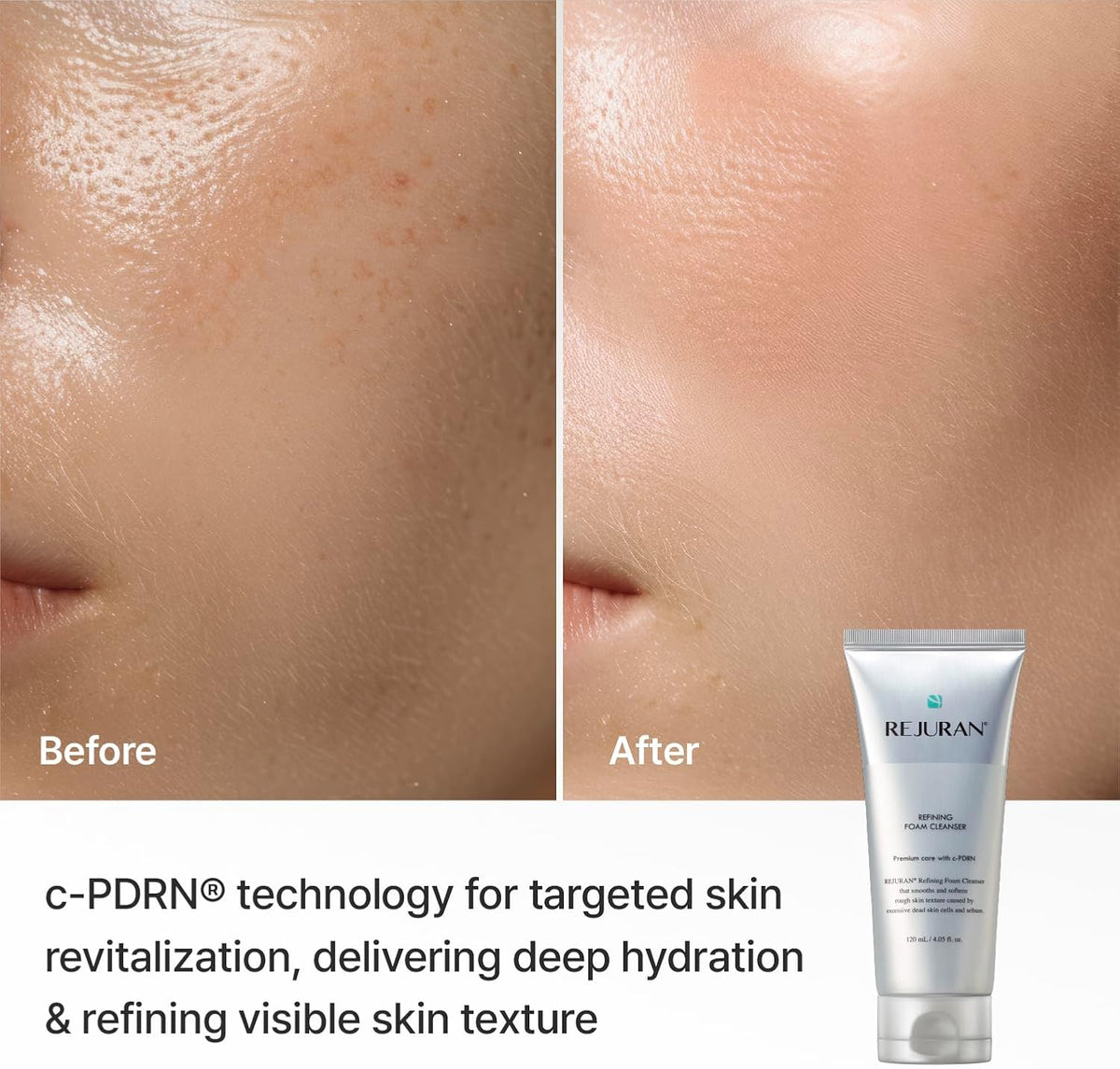Rejuran Refining Foam Cleanser ingredients and benefits label