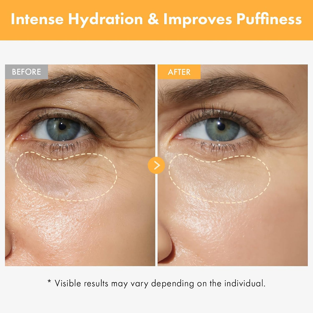 Close up of the Tosowoong Vitamin Eye Cream rollerball tip for under eye massage