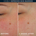 Texture of RoC Barrier Renew cream on skin