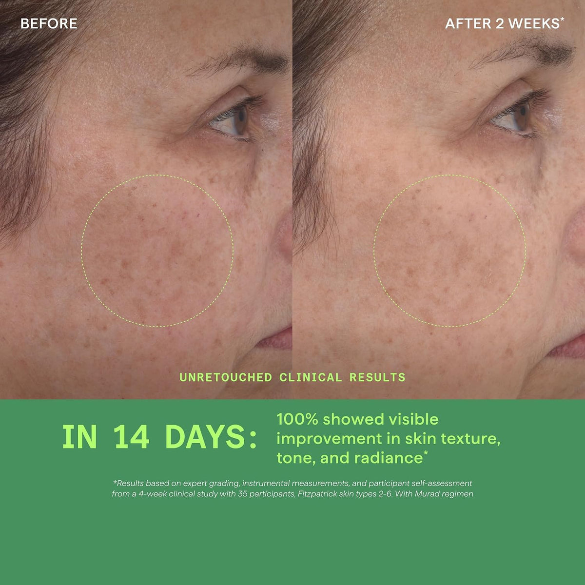 Murad Retinol Youth Renewal Serum ingredient highlights graphic