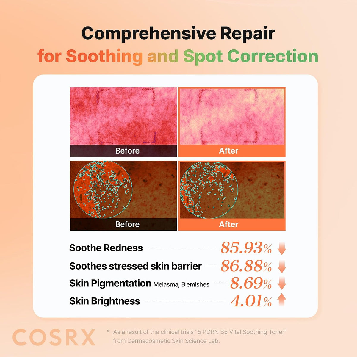 COSRX 5 PDRN Collagen Intense Vitalizing Serum dropper bottle demonstrating the non sticky texture.