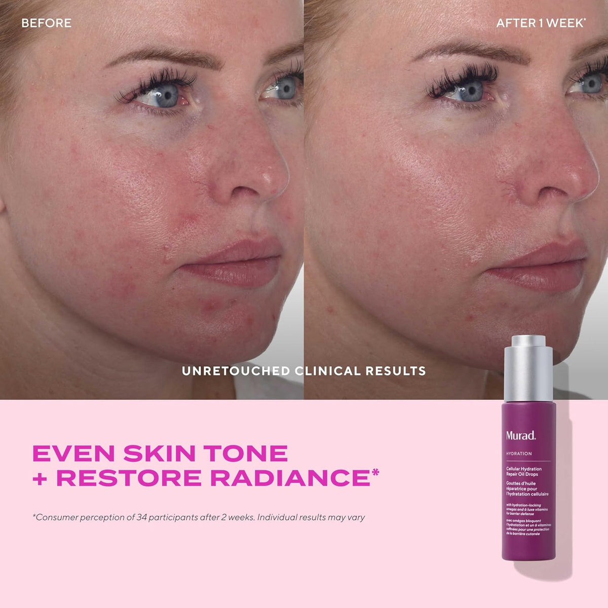 Murad cellular hydration repair oil drops thirty milliliter bottle placed on a clean background.