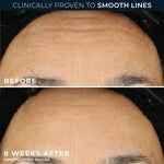 RoC Retinol Correxion packaging showing 10 count