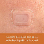 Rael skincare bundle packaging displaying active ingredients like Vitamin C and Niacinamide.