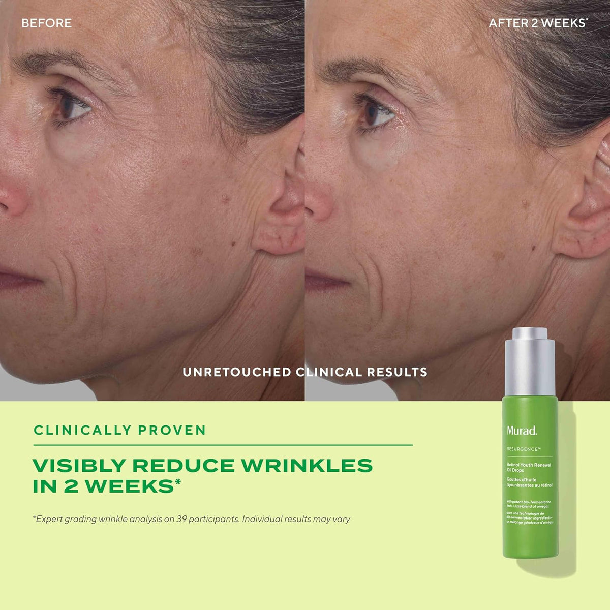 Murad Retinol Youth Renewal Oil Drops 1.0 fluid ounce bottle side view